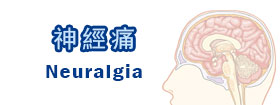 神經痛