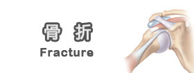 骨折